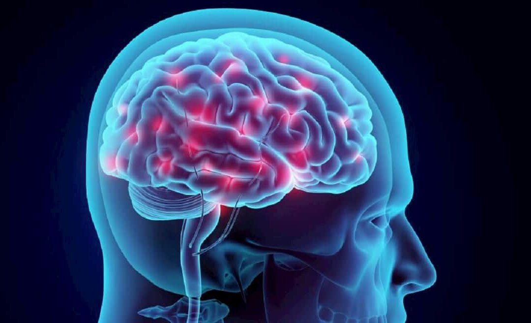What is Post-Concussion Syndrome?