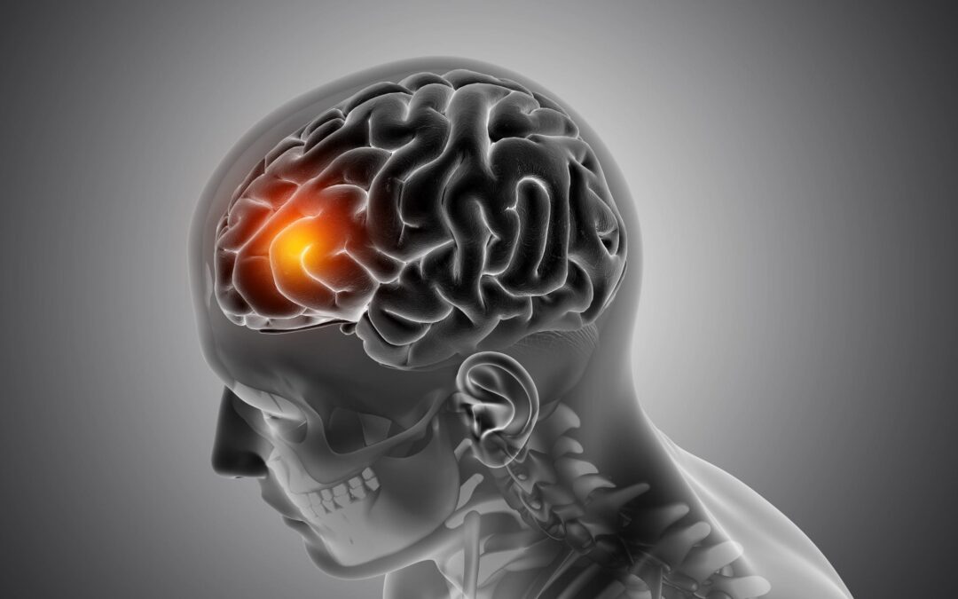 Brain Injury Awareness Month – MARCH